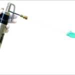 Intralesional CryoShape for the Treatment of Keloid
